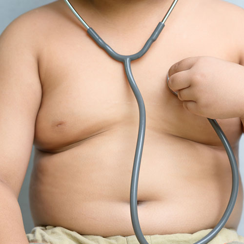 obesidad infantil
