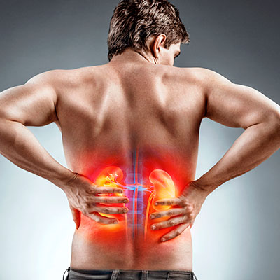 Hombre con dolor lumbar e ilustración de la anatomía renal resaltada para explicar cómo cuidar los riñones y detectar síntomas de enfermedad.