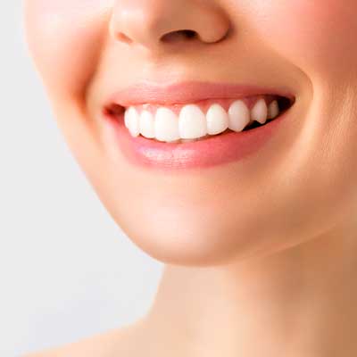 blanqueamiento dental