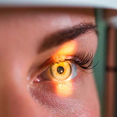 glaucoma que es