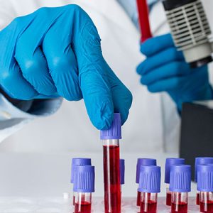 laboratorio-con-muestras-de-sangre