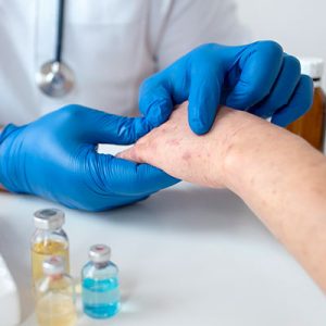 diagnostico de lupus