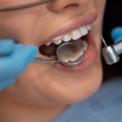 endodoncia de alta complejidad