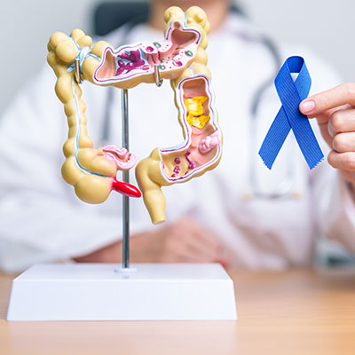 Médico especialista mostrando modelo anatómico de colon y cinta azul de prevención del cáncer de colon